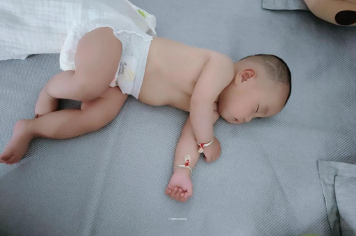 长岭六个月宝宝眼睛散光 长岭六个月宝宝眼睛散光